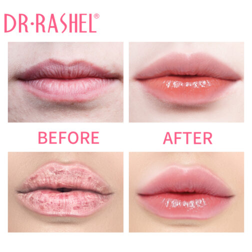 DR RASHEL LIP BALM PEACH - Image 3